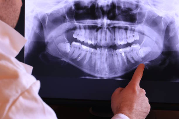 Best Emergency Root Canal Treatment in Hugoton, KS